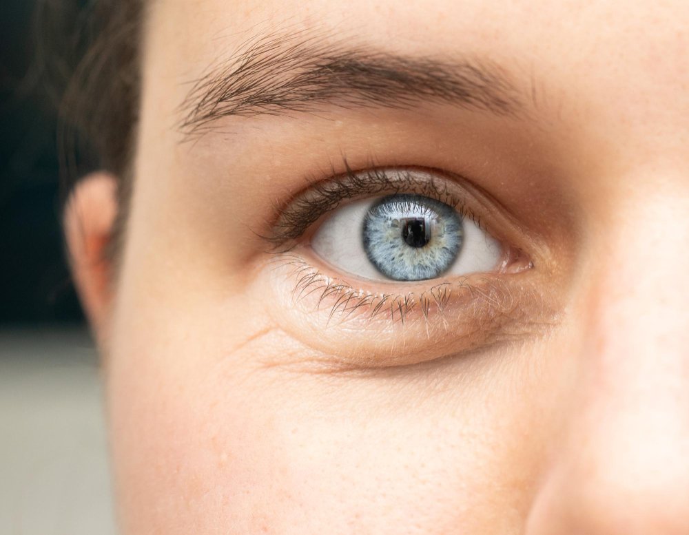 descolamento de retina