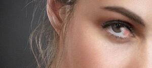 pterigio carne no olho