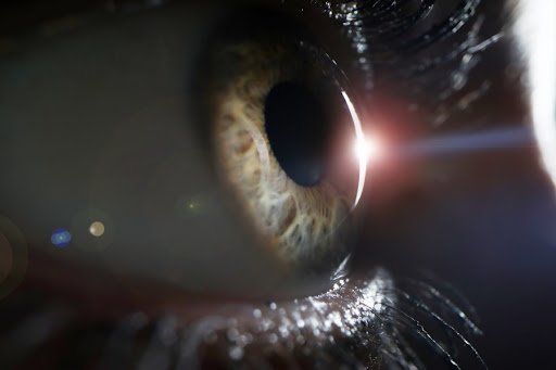 Cirurgia refrativa LASIK